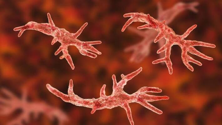 Brain eating amoeba: Warning issued in Florida after rare infection case Brain eating amoeba: Warning issued in Florida after rare infection case