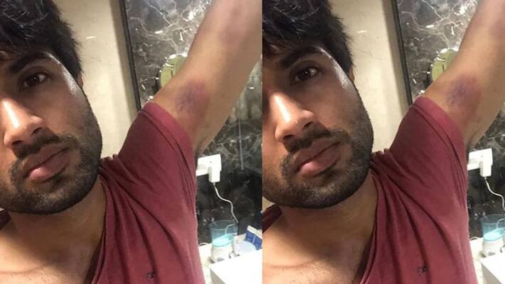 vijay devarakonda met accident in shooting spot vijay devarakonda met accident in shooting spot