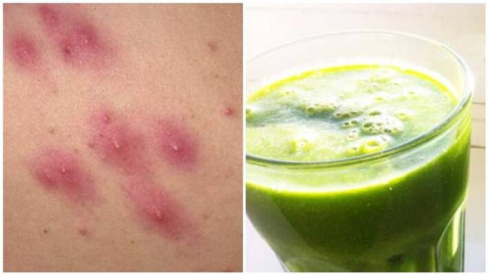 best method to control dengue best method to control dengue