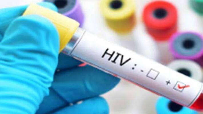 A woman dies of Shock after learning she is HIV found wrong report A woman dies of Shock after learning she is HIV found wrong report