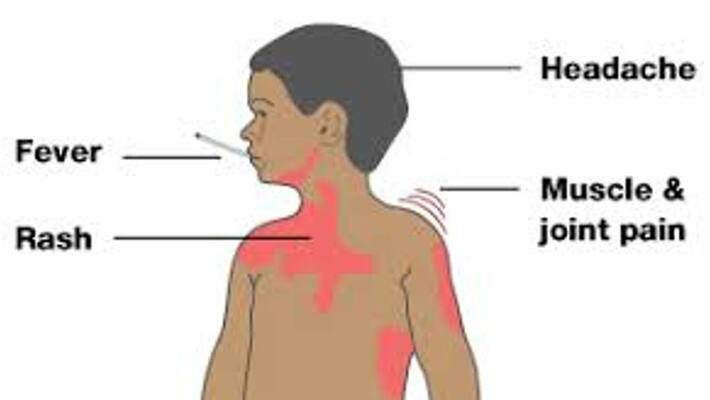 signs and symptoms of dengue signs and symptoms of dengue