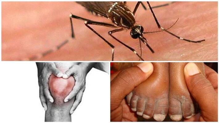 whether dengue will affect frequently ? whether dengue will affect frequently ?