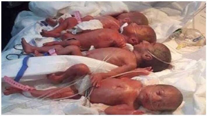 a lady gave birth to 7 babies in iraq a lady gave birth to 7 babies in iraq