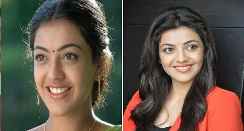 కాజల్ అగర్వాల్ - నోస్ జాబ్ సర్జరీ