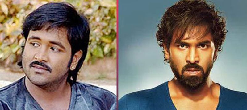 మంచు విష్ణు - లైపో సక్షన్