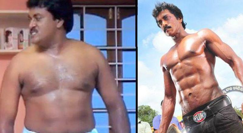సునీల్ - లైపో సక్షన్ థెరపీ, వెయిట్ రిడక్షన్ సక్షన్ థెరపీ