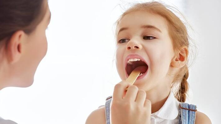 tonsillitis; causes and symptoms tonsillitis; causes and symptoms