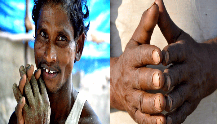 Journalist Suma bala's experience: Finger prints missing Journalist Suma bala's experience: Finger prints missing