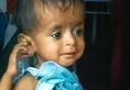 Malnutrition cases are increasing in MP of Kamalnath