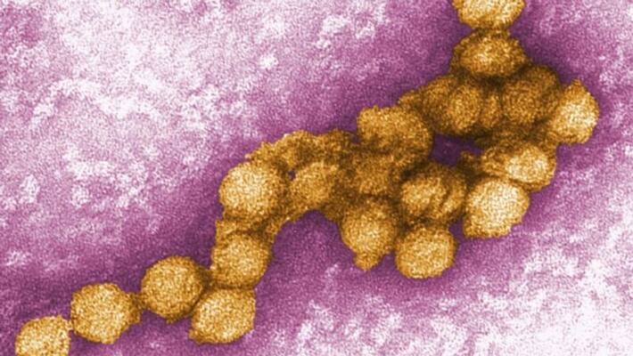Teenager recovers from near death in world first GM virus treatment Teenager recovers from near death in world first GM virus treatment