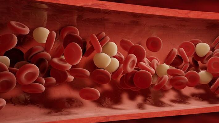 Know the symptoms of blood clot in body ABSC Know the symptoms of blood clot in body ABSC