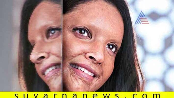 Deepika Padukone Chhapaak gets U certificate from CBFC Deepika Padukone Chhapaak gets U certificate from CBFC