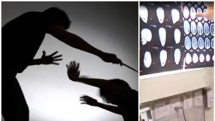 Medical board says, assaulted kid in Thodupuzha is not brain dead Medical board says, assaulted kid in Thodupuzha is not brain dead