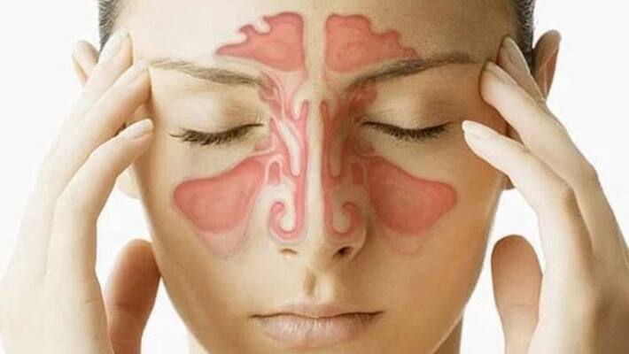 know about sinusitis and its causes and treatment know about sinusitis and its causes and treatment