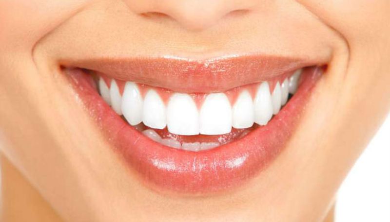 Teeth whitening tips one must try at home