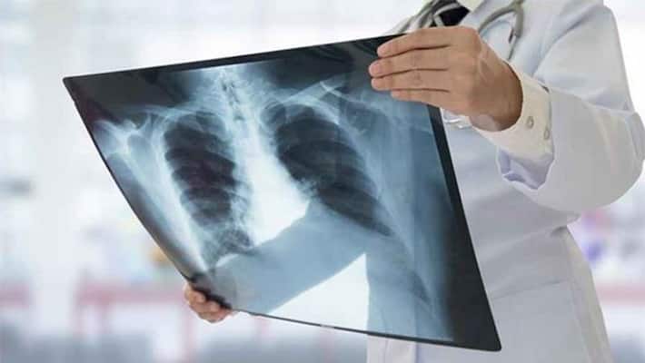 steel glass in odisha mans private part.. removed through surgery steel glass in odisha mans private part.. removed through surgery