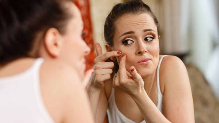 we can remove pimples very easily if we apply this daily on face we can remove pimples very easily if we apply this daily on face