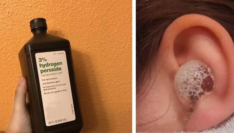 Try Out These Easy And Harmless Ways To Clean Your Ears Without Earbuds