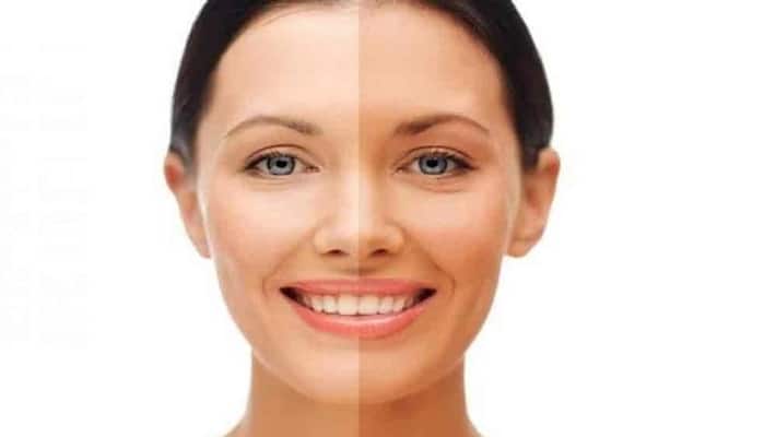 some home remedies to get rid of sun tan some home remedies to get rid of sun tan