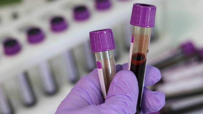What is Bombay Blood Group - Know everything about it What is Bombay Blood Group - Know everything about it