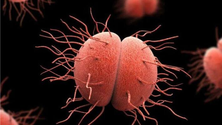 researchers says that gonorrhea can transmit through kiss researchers says that gonorrhea can transmit through kiss