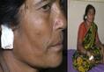Woman loses both ears in quarrel over water in Kolar