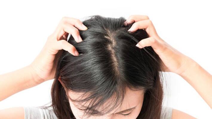 If you have Itchy Scalp problem then know about these Effective Home Remedies If you have Itchy Scalp problem then know about these Effective Home Remedies