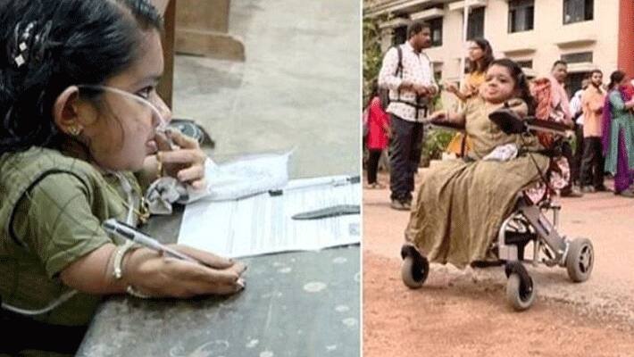 Kerala woman with rare bone disorder appears for UPSC exam