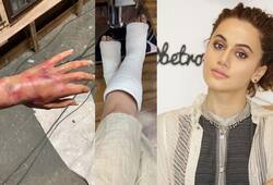 taapsee pannu shares her injured photos