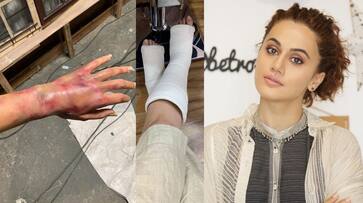 taapsee pannu shares her injured photos