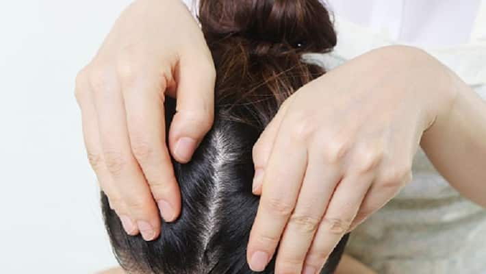 4 Remedies for itchy scalp 4 Remedies for itchy scalp