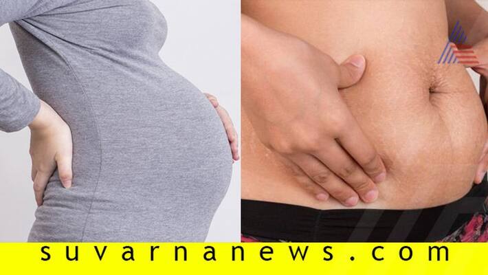 6 Tips to be stay fit after delivery 6 Tips to be stay fit after delivery