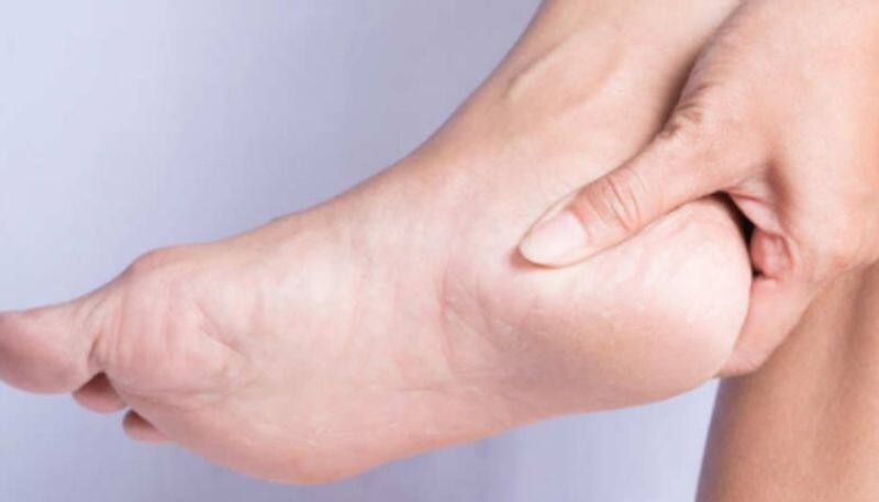 How to heal cracked heels during winter with home remedies