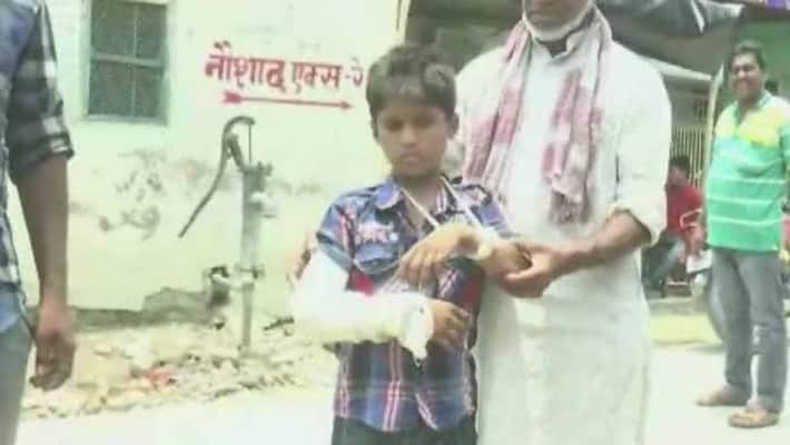doctors cast plaster on boys wrong arm in bihar doctors cast plaster on boys wrong arm in bihar