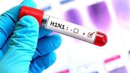 h1n1 virus causes Symptoms and effective remedies to deal with It