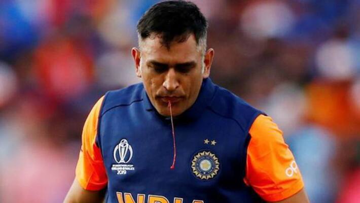 latest update on dhoni injury and his presence in sri lanka match latest update on dhoni injury and his presence in sri lanka match