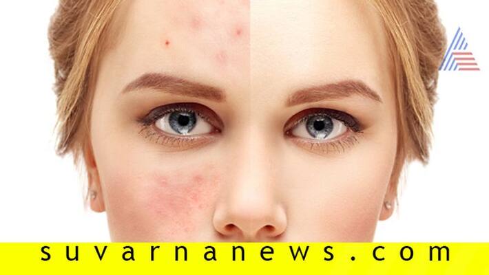 5 Mistake you commit in night will damage your skin 5 Mistake you commit in night will damage your skin