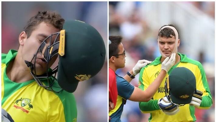 world cup 2019: australia player alex carey injured in semifinal2 match world cup 2019: australia player alex carey injured in semifinal2 match