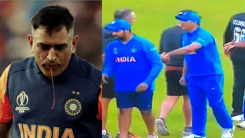 MS dhoni ignore injury scare and played world cup semifinal