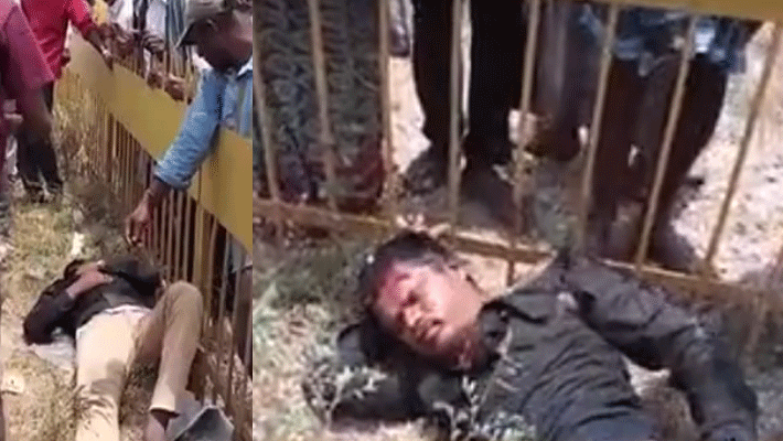 vivo smartphone blast...youth Injury vivo smartphone blast...youth Injury