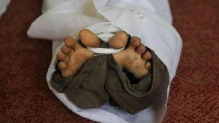 family kept dead body 18 month assuming coma in kanpur UP apa family kept dead body 18 month assuming coma in kanpur UP apa