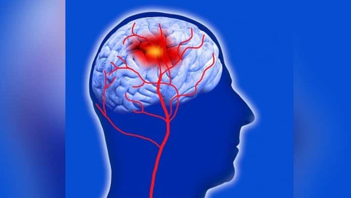 Did you know more screen time can push you closer to stroke risk all about it gcw Did you know more screen time can push you closer to stroke risk all about it gcw