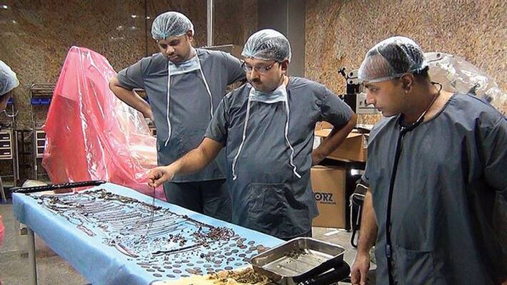1.5 kg ornament with 90 coins removed from girls stomach in Bengal 1.5 kg ornament with 90 coins removed from girls stomach in Bengal