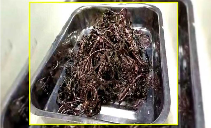 वीरभूम के एक सुपर स्पेशलिटी अस्पताल में रूनी का ऑपरेशन किया गया। हुआ यूं था कि कुछ दिन पहले रूनी को पेट दर्द हुआ। जब हॉस्पिटल में डॉक्टर ने जांच की, तब पेट में धातु के टुकड़े दिखाई दिए। डॉ. सिद्धार्थ विश्वास के अनुसार पांच डॉक्टरों के दल ने युवती के पेट का ऑपरेशन किया। यह करीब सवा घंटे तक चला। ऑपरेशन के बाद रूनी पेट से सोने की चेन, अंगूठी, घड़ी, आदि गहने निकले। उसके पेट से 60 से ज्यादा सोने के सिक्के भी मिले।