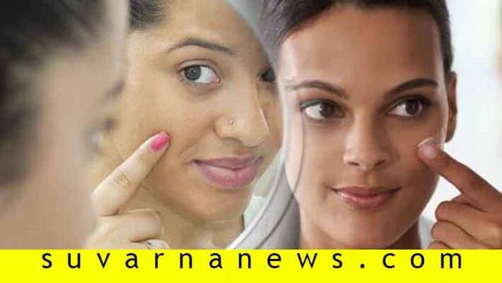 7 simple ways to remove black mark from face 7 simple ways to remove black mark from face