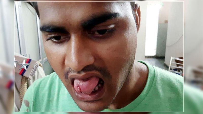 जयपुर. अपने दोस्त की बर्थ-पार्टी के बाद ओला कैब से चित्रकूट एरिया स्थित अपने घर लौट रही 21 साल की मॉडल के साथ रेप की कोशिश का मामला सामने आया है। आरोपी पहले से ही कैब में बैठा हुआ था। हालांकि लड़की ने बहादुरी दिखाई और जबर्दस्ती किस कर रहे आरोपी की जीभ काट ली। इसके बाद कैब से कूदकर भाग गई। वो सीधे पुलिस थाने पहुंची। पुलिस ने दोनों आरोपियों को अरेस्ट कर लिया है। पुलिस के अनुसार लड़की चित्रकूट इलाके में किराए से रहती है। वो मूलत: आगरा से है। लड़की बीबीए की स्टूडेंट है। साथ ही मॉडलिंग भी करती है। गुरुवार रात करीब 1.12 बजे उसने आश्रम मार्ग स्थित जी-क्लब से ओला कैब बुक कराई थी। यहां वो एक बर्थ-डे पार्टी में आई थी। युवती के मुताबिक, एक आरोपी सचिन पहले से ही ड्राइवर सुरेश की बगल वाली सीट पर बैठा था। ड्राइवर ने उसे बताया कि सचिन उसका दोस्त है। उसे भी चित्रकूट जाना है।