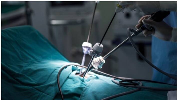 mumbai byculla hospital creates a new record by doing minimal invasive surgery mumbai byculla hospital creates a new record by doing minimal invasive surgery
