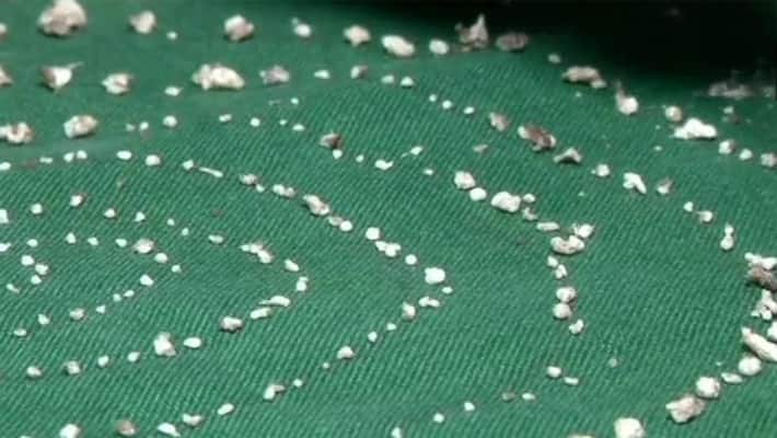 Chennai doctors Removed 526 teeths from 7 year old child Chennai doctors Removed 526 teeths from 7 year old child