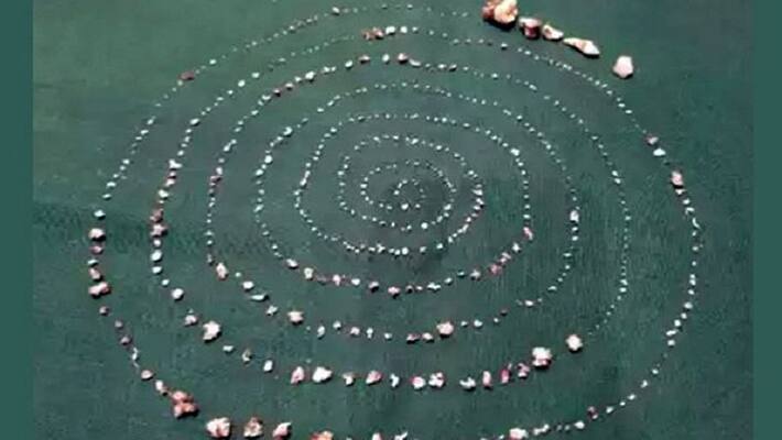 Doctors Remove 527 Teeth From 7 Year Old Chennai Boy Mouth Excluding 21 Healthy Ones Doctors Remove 527 Teeth From 7 Year Old Chennai Boy Mouth Excluding 21 Healthy Ones