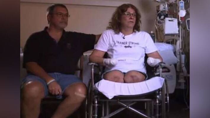 American woman became handicapped due to infection from pet dog American woman became handicapped due to infection from pet dog
